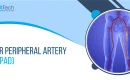 peripheral arterial disease icd 10
