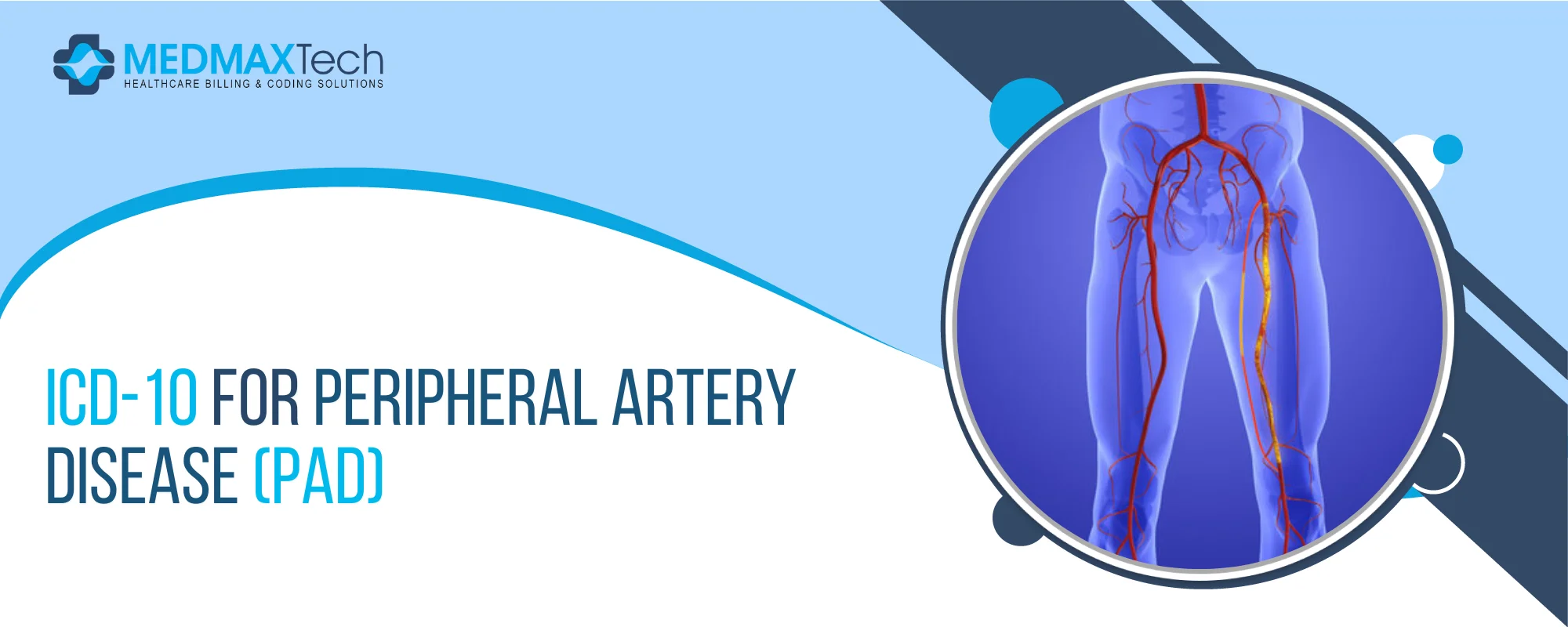 peripheral arterial disease icd 10